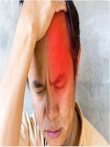 Urgent!! Get Rid Of Your HEADACHE-1 Hour Delivery Pain Is Gone! - £32.07 GBP