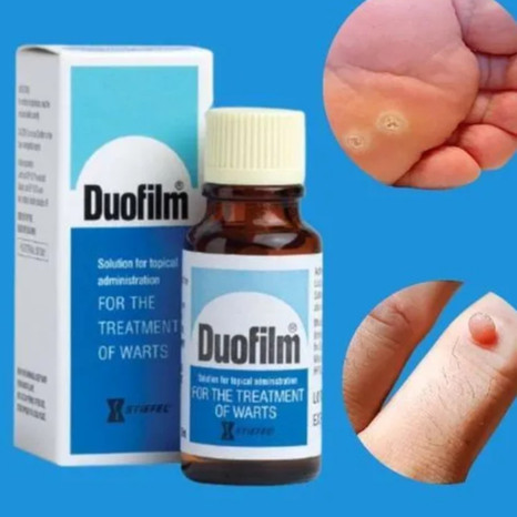 1x DUOFILM 15ml Salicylic Acid For Removing Plantar Warts Corns And Calluses