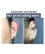 Protruding ear corrector EARCLIC - $50.00