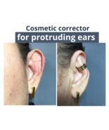 Protruding ear corrector EARCLIC - £39.33 GBP