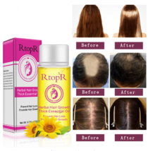 Fast Powerful Hair Growth Products Essential Oil Liquid Treatment Preventing Hai - £12.06 GBP+
