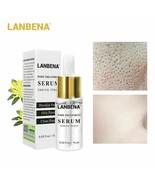 2 pack Pore Shrinkage Remove Blackhead Whitehead Acne Deep Cleansing Whi... - $16.17 CAD