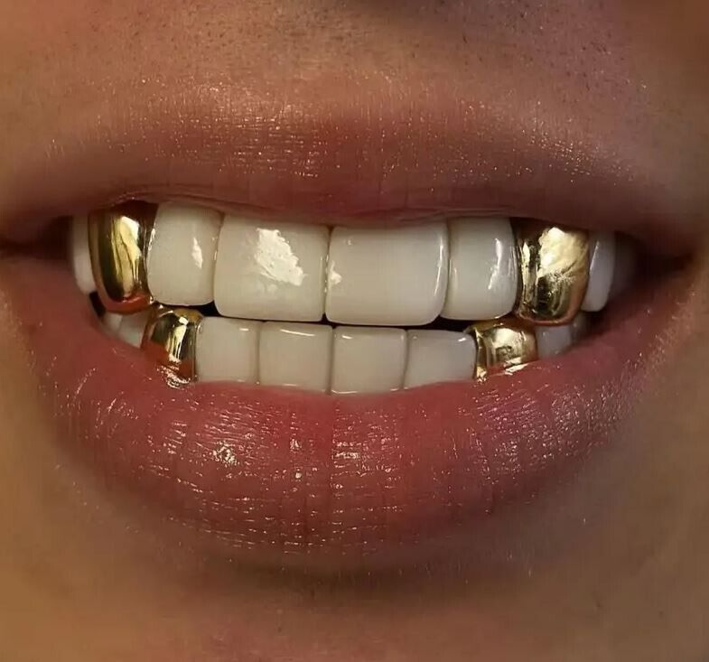 Hip Hop 14K Gold Plated Single Tooth Solid Grillz Grill Cap with Mold Ki... - $23.75