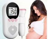 NeoPulse Fetal Doppler – Accurate Baby Heartbeat Monitor with Large LCD ... - £32.95 GBP