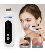 Ultrasonic Skin Scrubber 5 Modes EMS Blackhead - $26.99