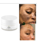 Sunburn Remover Face Cream, Dark Mark Fade Cream - $29.22