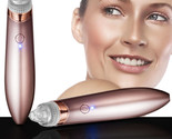 Pore Blackhead Cleaner Remover Vacuum Acne Cleanser Facial Skin Care Ele... - $18.32
