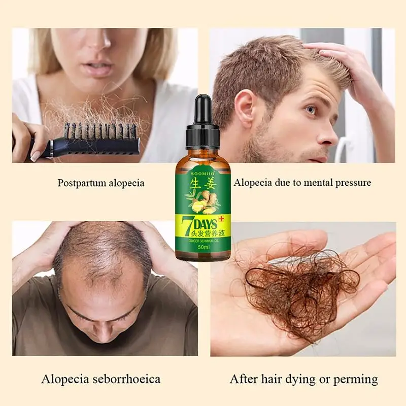 House Home Ginger Hair Growth Spray Serum For Anti Hair Loss Essential A Product - £19.98 GBP