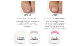 Fuzion UV/LED Nanoflex Conceal Toe Nail Restore Sampler Kit image 2