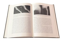 1957 Surgical Clinics of North America Hardcover – Common Operations Issue Vtg image 8