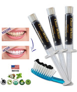 Activated Charcoal Gel for Natural Teeth Whitening - Fresh Teeth Whiten... - $17.08 CAD