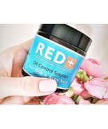 Acne Facial Cream 240 gr |Acne Treatment | Organic Facial Cream |Vegan s... - $54.86 CAD
