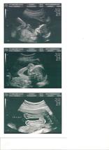 REAL US PAPER Fake Prank Gag Custom Positive Pregnancy 2D Ultrasound Sonogram - £53.94 GBP