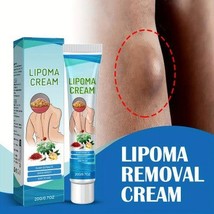 Lipoma Cream, Contains Ginger And Castor Oil, Body Care Cream For Moistu... - $16.13