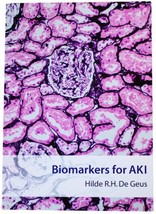BIOMARKERS FOR AKI Acute Kidney Injury HILDE R.H. DE GEUS Paperback PhD ... - $59.39