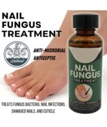 Anti Fungal Nail Treatment Nail Finger Toe Fungus Onychomycosis Remover - £18.33 GBP