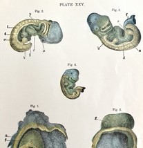 Human Embryo 5th Week Development 1878 Victorian Medical Anatomy Print DWV6A - £31.89 GBP