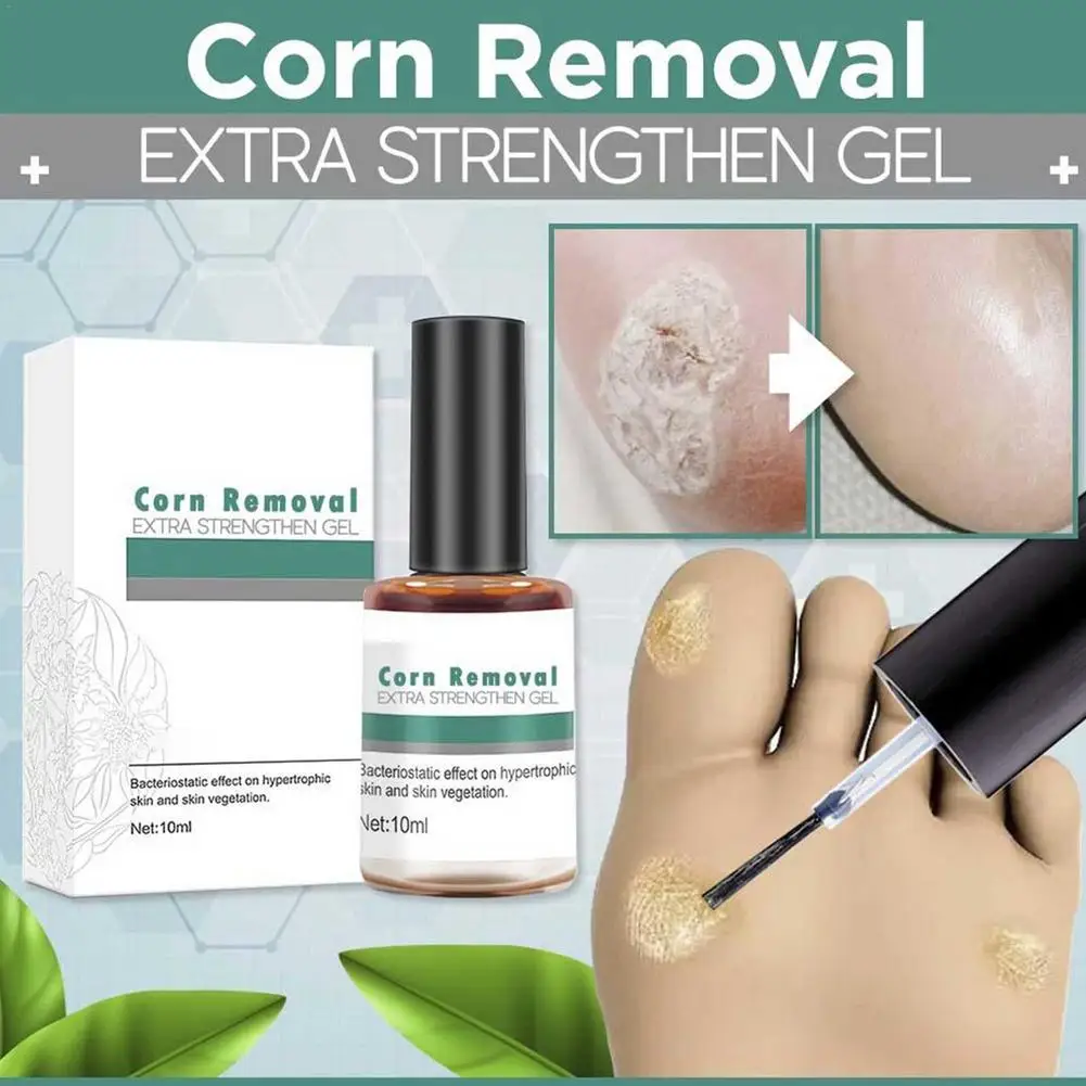 Sporting 10ML Remover Foot Corn Care Gel Warts Remover Skin Tag Remover Warts A  - £23.38 GBP