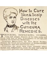 1887 Cuticura Victorian Quack Medicine Potter Boston Advertisement 3x2.5 - $28.05 CAD