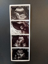 US PAPER Fake Prank Gag Custom 4 PHOTO Pregnancy 2D Ultrasound Sonogram  - $79.00