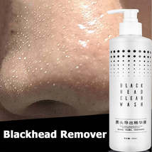 Blackhead Exporting Liquid With Small Bubble Device for  Deep Cleansing ... - £10.23 GBP+