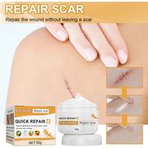 Desalting Skin Scar Cream, Skin Burn Scalding Surgical Scar Wound Repair... - $28.96 CAD