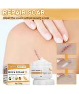 Desalting Skin Scar Cream, Skin Burn Scalding Surgical Scar Wound Repair... - $28.96 CAD