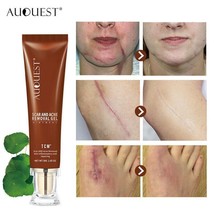 Acne Scar Removal Cream Pimples Stretch Marks Face Whitening Moisturizing - $150.34 MXN