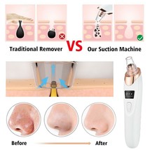 Pore Vacuum Blackhead Remover Moisture Facial Suction Blackheads Black S... - £18.43 GBP