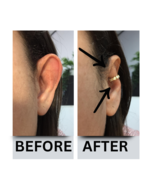 Earcuff for big ear, big ear corrector - $35.00