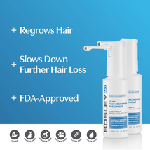 BosleyMD Men's Hair Regrowth Spray 5%, 2 Oz. image 2