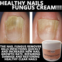 Nail Bright Nail Fungus Cream Lotion Stops Brittle Broken Nails Anti Fungal - £22.37 GBP