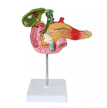 1:1 Life Size Pancreatic Duodenal Gallbladder Pathological Anatomical Model - $60.86