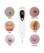 Ion Laser Freckle Skin Mole Dark Spot Remover Face Wart Tag Tattoo Removal Pen - £23.56 GBP