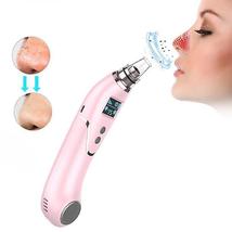 Electric Blackhead Remover Pore Cleaner Hot Cold Whitehead Removal Tool Beauty - £37.04 GBP