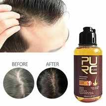Herbal Thickening Shampoo Ginseng Hair Care Essence Treatment Hair Loss Help - £17.96 GBP