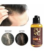 Herbal Thickening Shampoo Ginseng Hair Care Essence Treatment Hair Loss ... - £17.97 GBP
