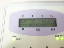 BIONET CARDIOCARE 2000 EKG-2000 ECG/EKG machine - $480.15