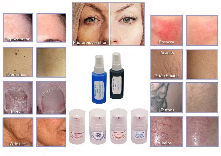 Tratamiento Spray & Gel Pack 4 Láseres ND de Colágeno Co2 Reductor de Arrugas.