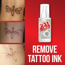 Inked Up Tattoo Fading Oil – Remove Tattoo Get Rid Of Ink Clear Skin - £28.79 GBP