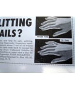 Splitting Nails? Knox Unbranded Gelatine Print Magazine Advertisement 1956 - $2.70 CAD