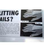 Splitting Nails? Knox Unbranded Gelatine Print Magazine Advertisement 1956 - £1.55 GBP