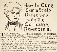 1887 Cuticura Victorian Quack Medicine Potter Boston Advertisement 3x2.5 - $378.90 MXN