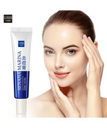 Face Skin Care Acne Treatment Removal Cream Spots Scar Blemish Marks - $8.66