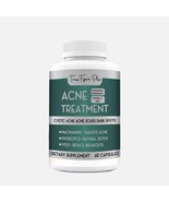 Acne Relief Tablets for Radiant, Blemish-Free Skin- Clearer Skin, Reduce... - $44.99