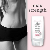 YUMMY MUMMY AFTER BIRTH GET RID OF STRETCH MARKS FADE APPEARANCE &amp; TEXTURE - £26.75 GBP