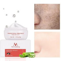 Whitening Freckle Cream Removes Dark Spot Lightening Bleaching Face Skin Care... - £13.92 GBP