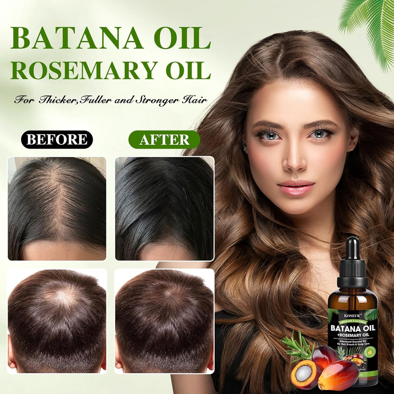 Batana Oil for Hair Growth and Rosemary Oil for Hair Growth, Nourish Dry Damaged Item image 3