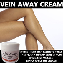 Vein Away Cream Lotion Max Strength Treatment Anti Thread Vein Spider Vein - £20.29 GBP