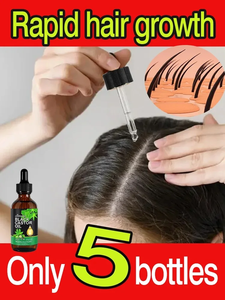 Stor oil for hair growth jamaican black castor oil nourish eyelashes and eyebrows scalp thumb200